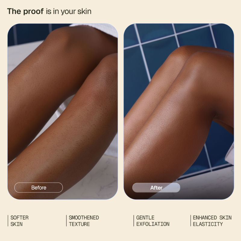 Arata 6.5% AHA BHA Body Lotion, Exfoliates & Hydrates, Reduces Bumps & Strawberry Skin