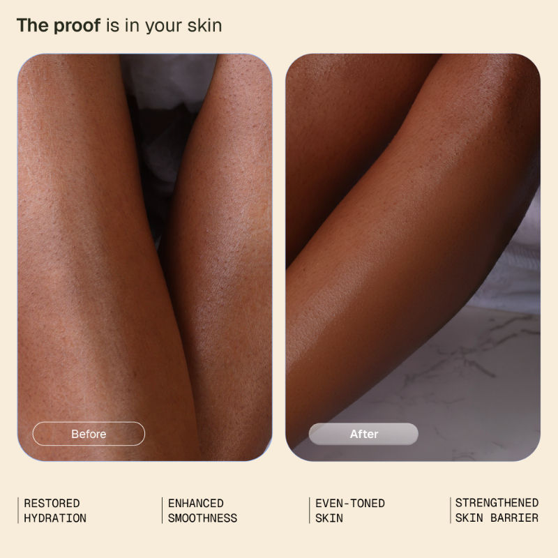 Arata Niacinamide Body Milk|Smooth, Hydrated & Even-Toned Skin|Spray Applicator