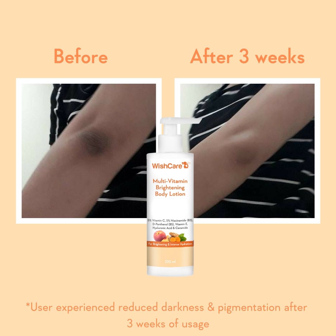 WishCare Multi-Vitamin Brightening Body Lotion for Glowing Skin-Reduces Pigmentation & Dark Spots