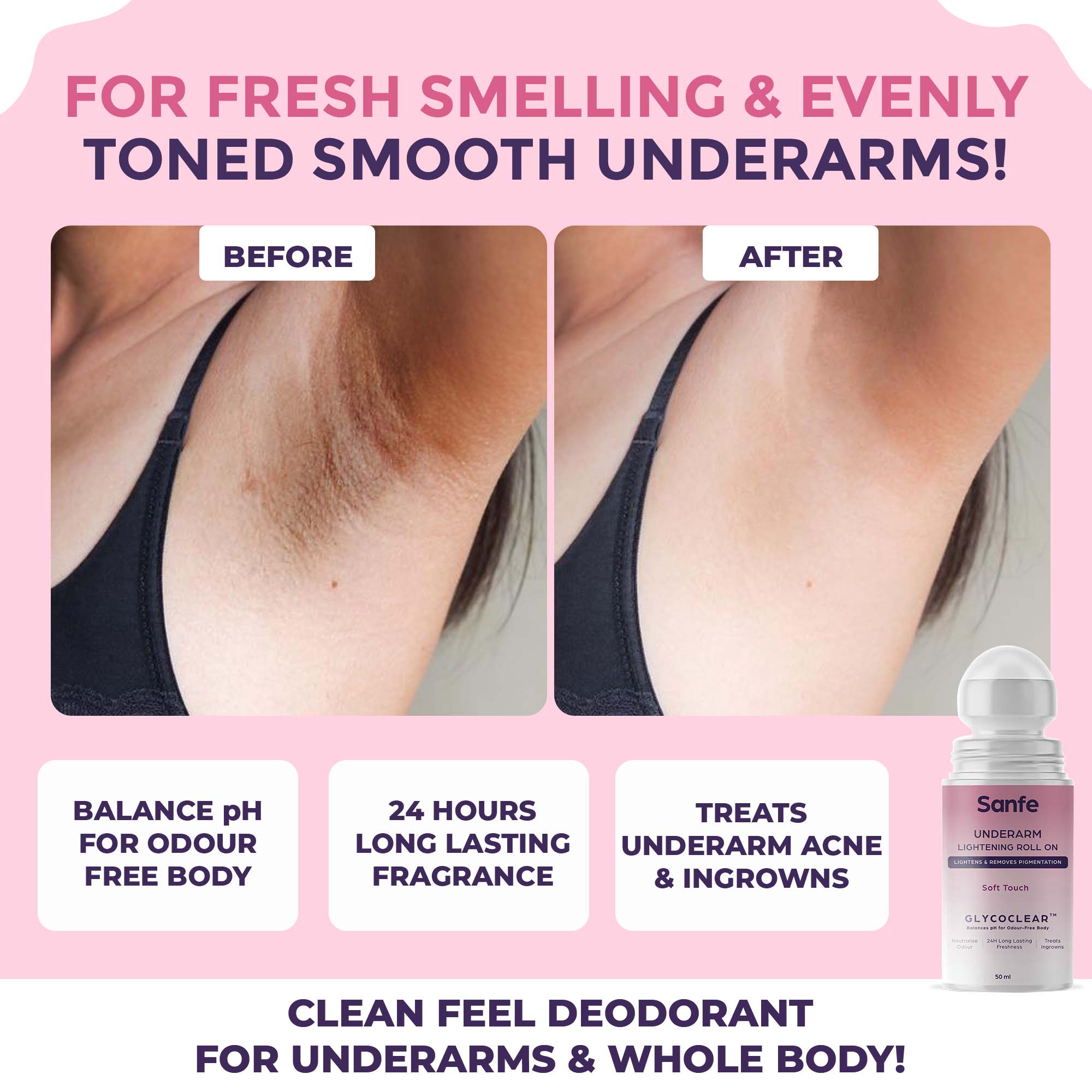 Sanfe Underarm Lightening Roll On (Soft Touch) with 5% AHA