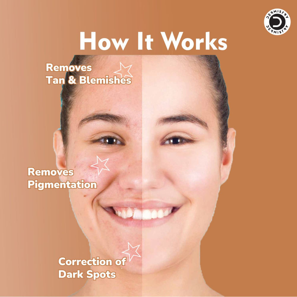 DERMISTRY Kojic Acid Face Cream Pigmentation Tan Removal Glowing Skin Whitening Lightening Fairness
