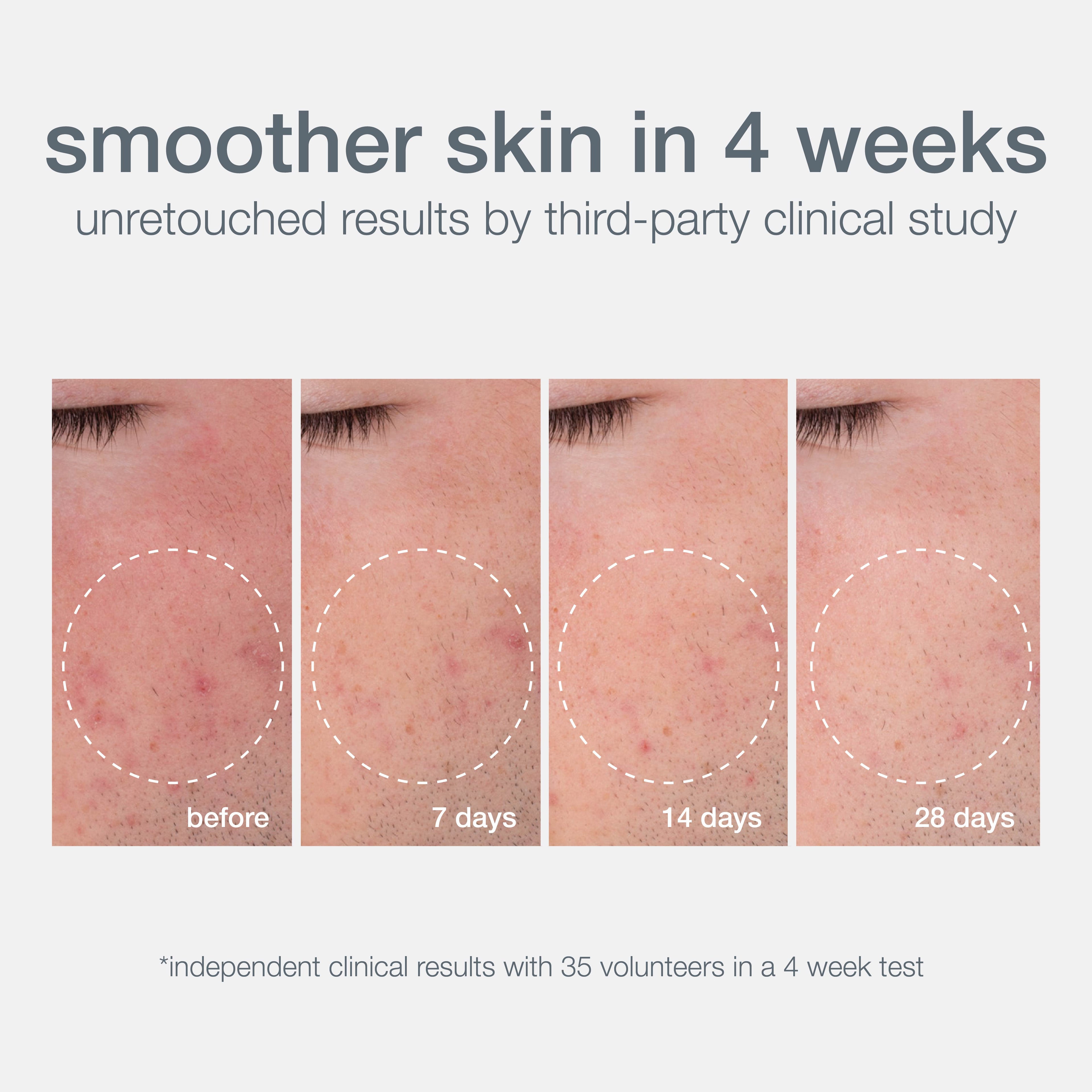 Dermalogica Daily Microfoliant Face Scrub