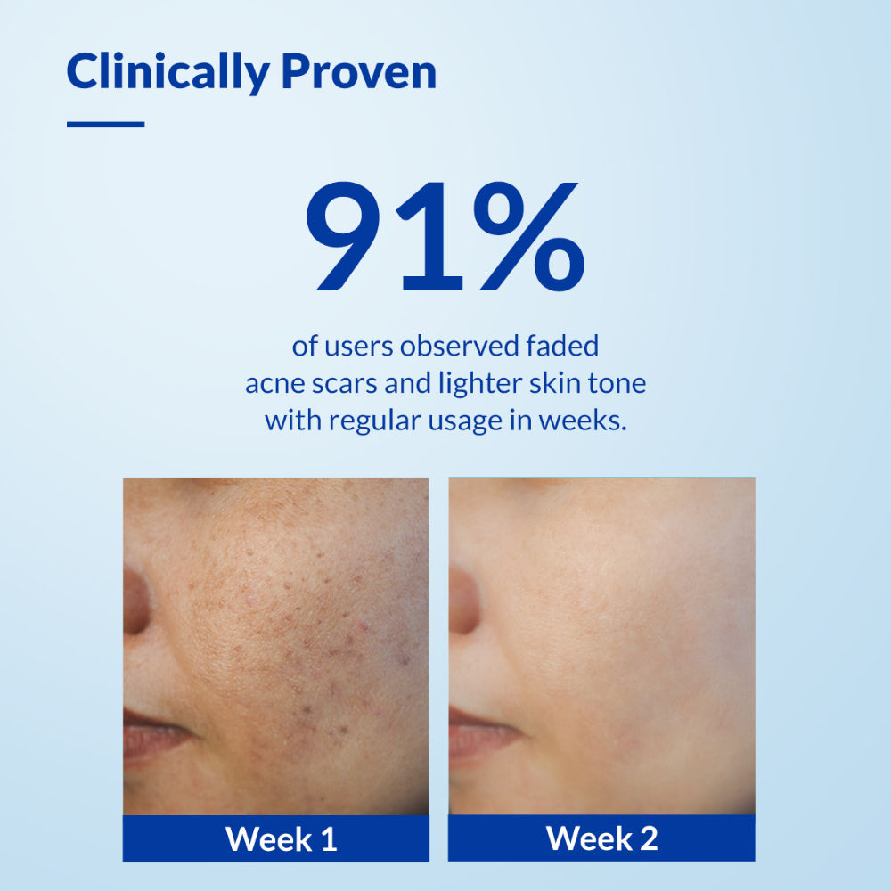 Fixderma Skarfix-TX Kojic Acid Face Wash for Pigmentation Control with Tranexamic Acid