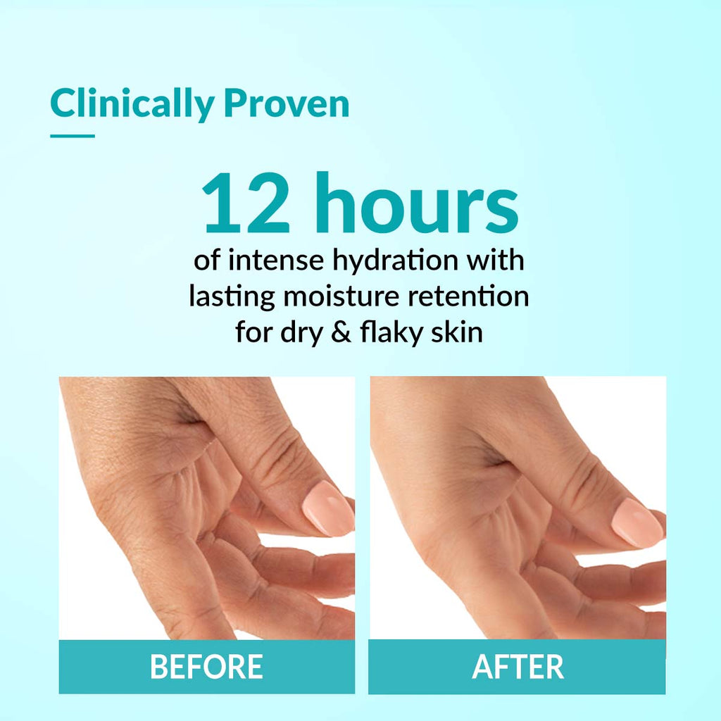 Fixderma Daily Moisturizing Cream For Hydration and Moisturization, NonComedogenic & NonGreasy