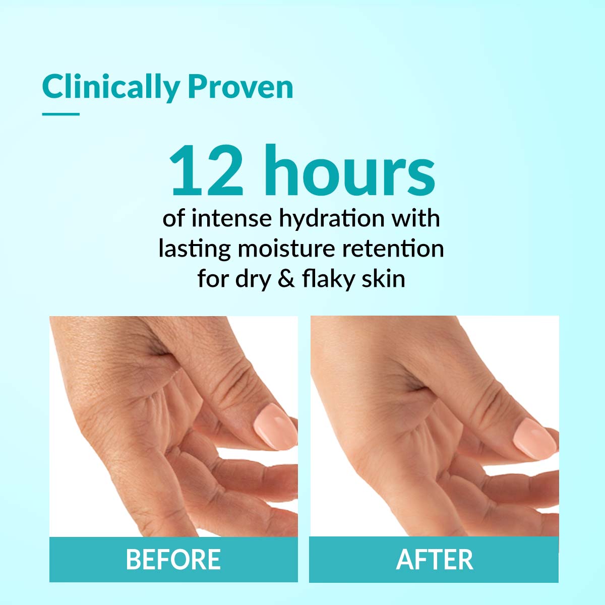 Fixderma Daily Moisturizing Cream For Hydration and Moisturization, NonComedogenic & NonGreasy