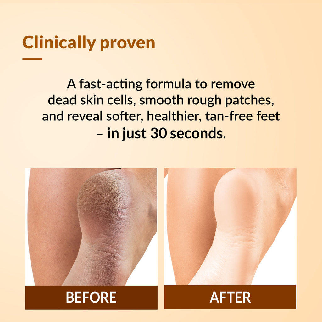 Fixderma Foobetik Foot Scrub Spray with 5% Lactic Acid & Shea Butter for Smooth Heels