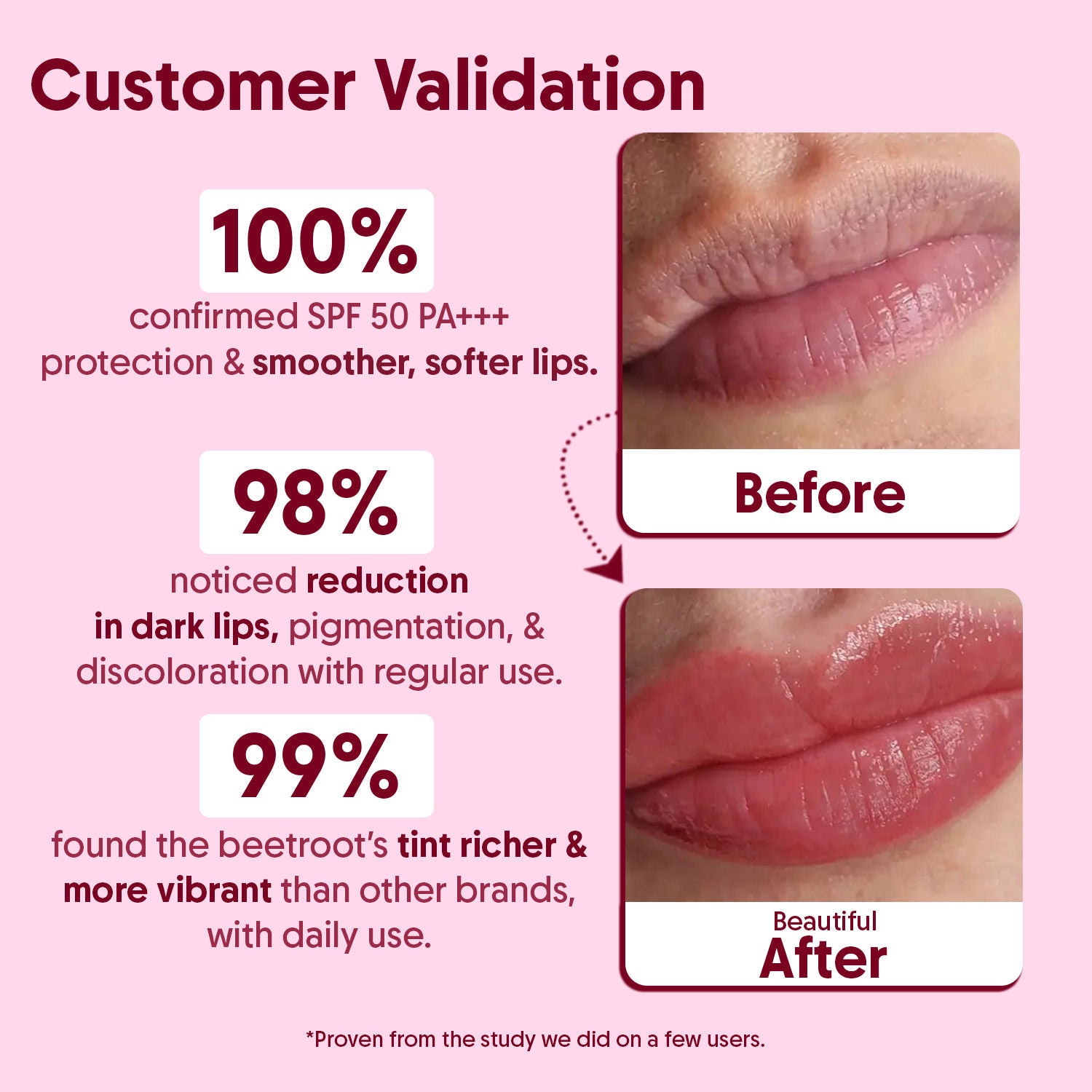 Aravi Organic Beetroot Tinted Lip Balm SPF 50 PA++++,Dry & Dark Pigmented Lips,Kojic Acid & Ceramide