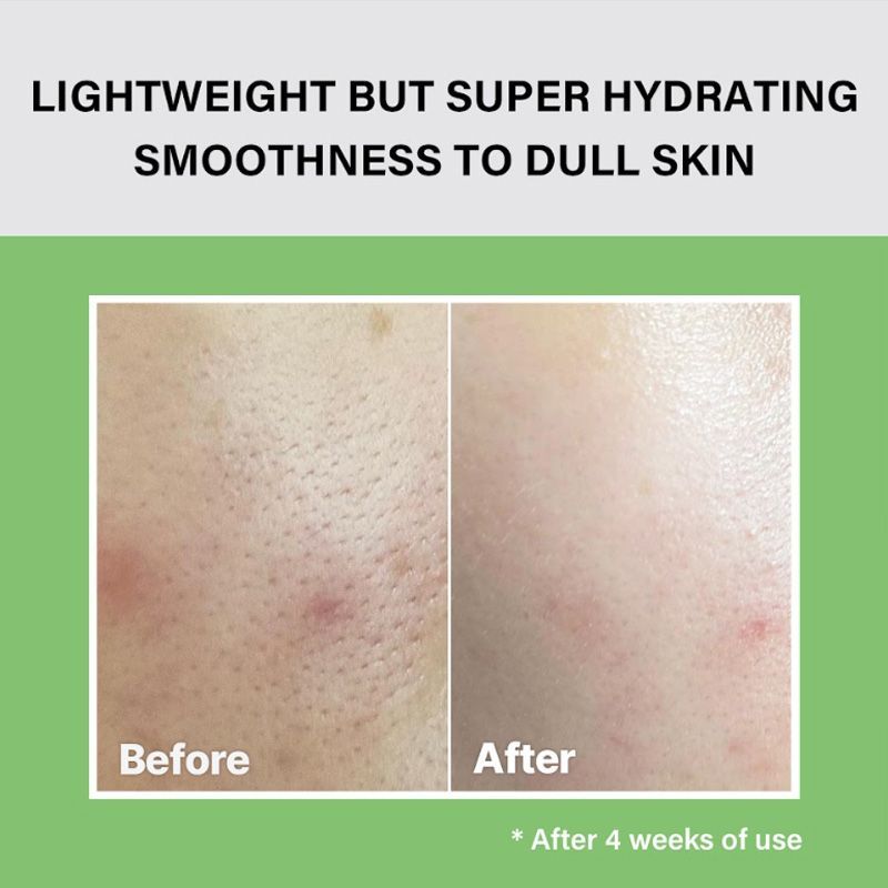 Celimax The Real Noni Moisture Balancing Toner, Hydrating & Brightening Exfoliating Toner