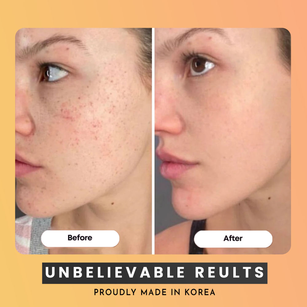 WILDGLOW Turmeric & Kojic Acid Face Cleansing Pads