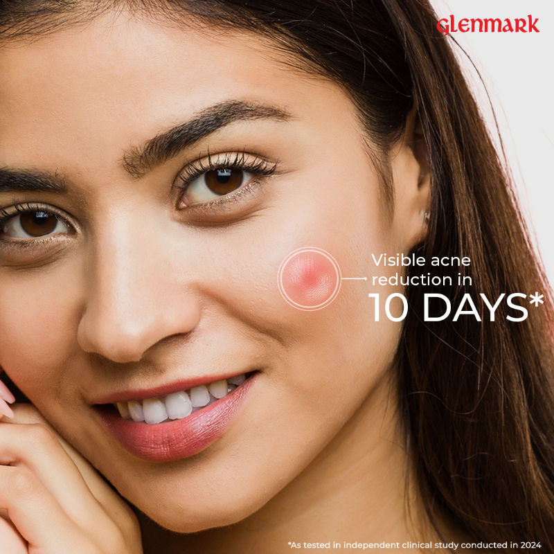 D'Acne Soft Face Wash, Visible Acne Reduction in 10 Days, 2% Niacinamide & 1% Glycolic Acid
