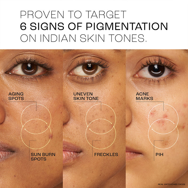 Lakme Perfect Radiance Pigmentation Treatment Gel with 10% Niacinamide Resorcinol Complex, 50g