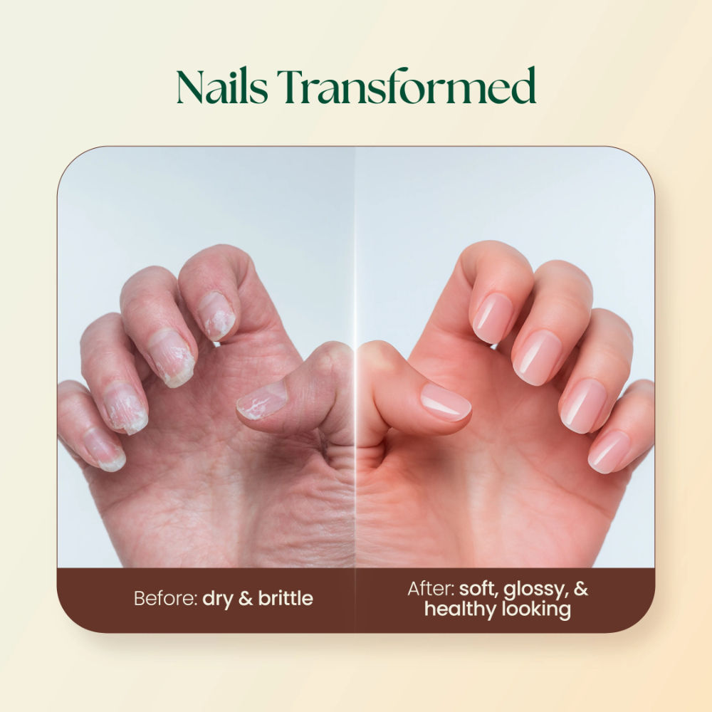 Moha Nail Care Cream Strengthen Dry Nails And Promote Shiny Glow