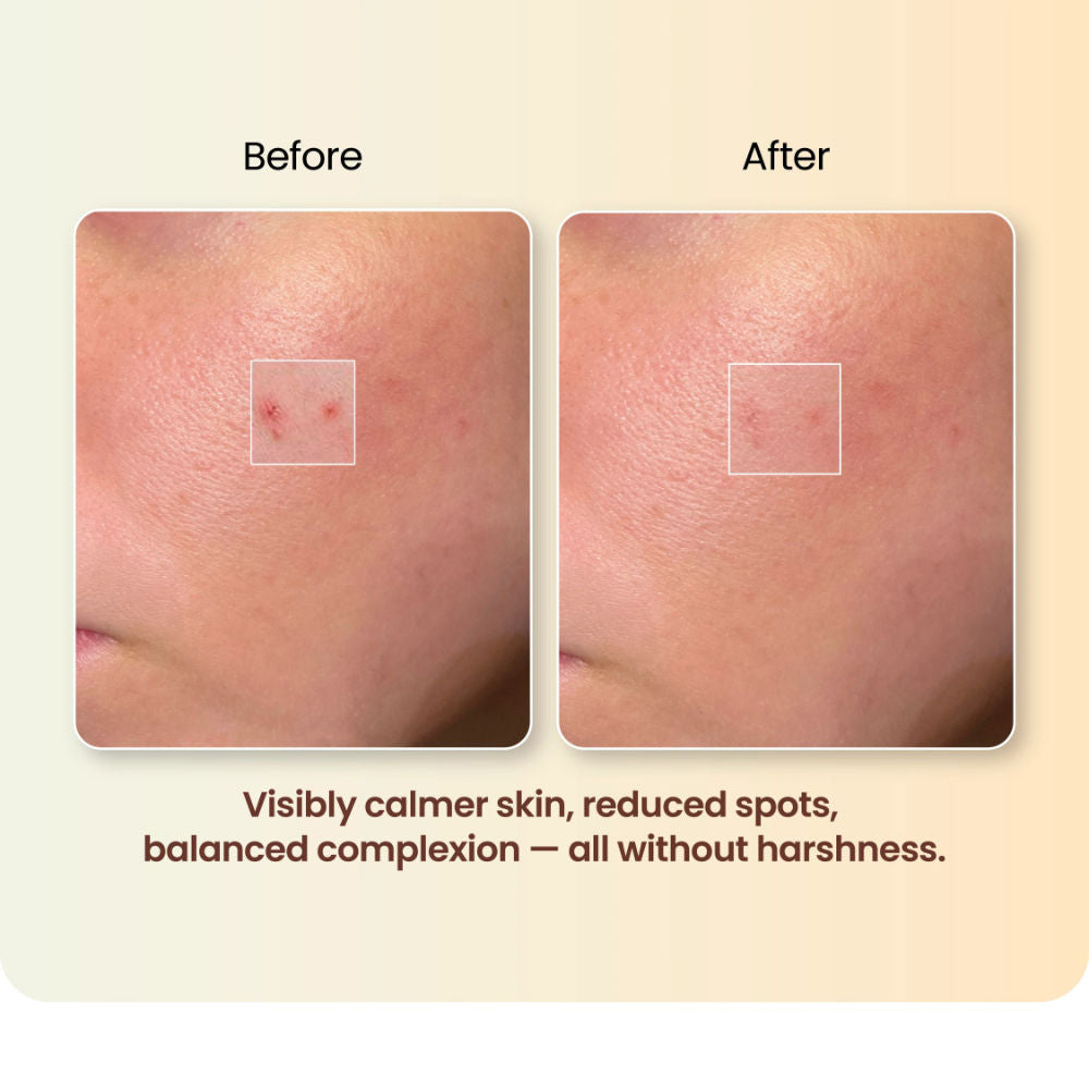 Moha Spot Corrector Gel