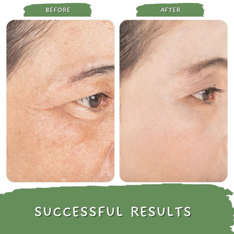 Mystiq Living Anti Ageing Cream for Women, Wrinkle Face Cream With Ceremide & Collagen Peptide