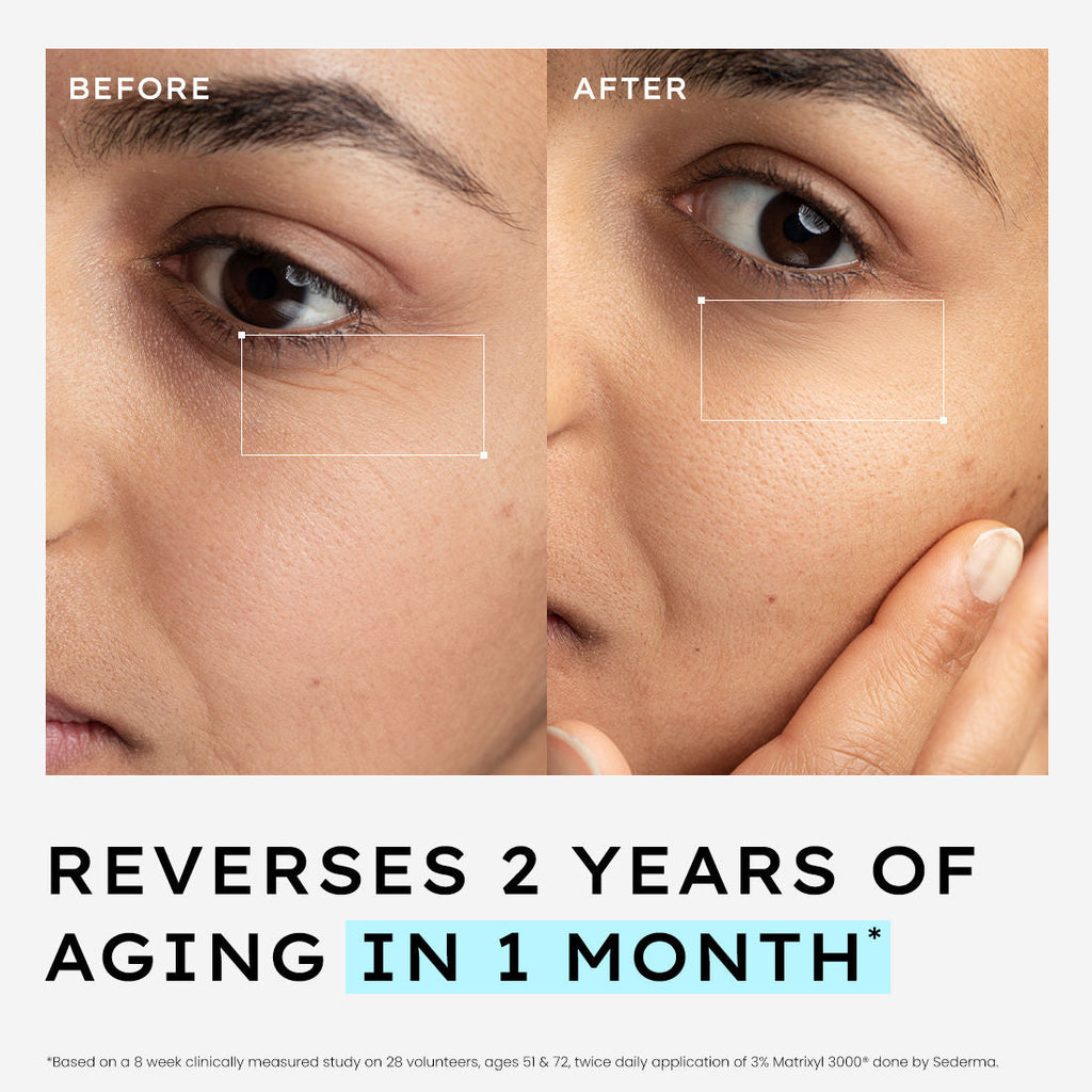 Hyphen 10% Power Peptide Cocktail Serum