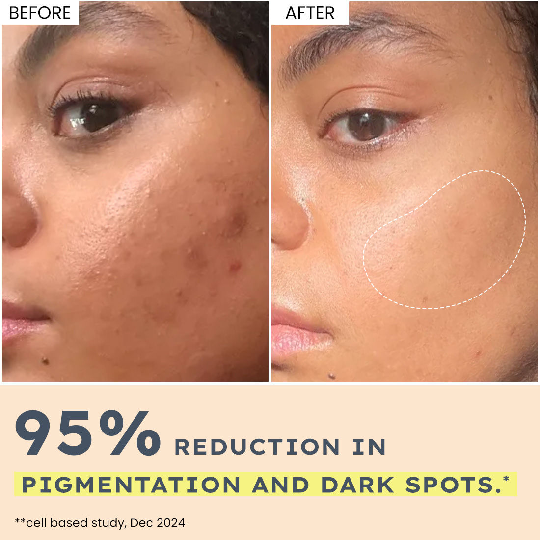 Hyphen 44% Rice Water Brightening Serum Pads