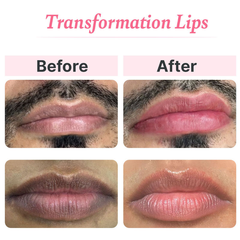 ALANNA Beet & Berry Lip Scrub, Gentle Beetroot Exfoliation for Soft, Glossy Lips, For Women & Men