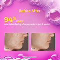 Chemist at Play 2% Salicylic Acid Face Wash For Oily Skin with Niacinamide Oil Cleanser for Face