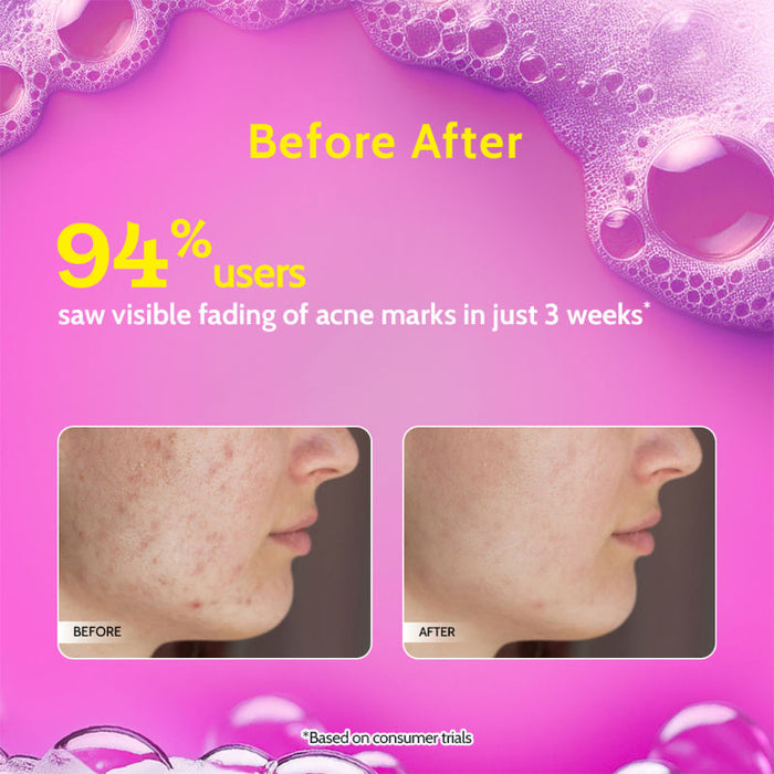Chemist at Play 2% Salicylic Acid Face Wash For Oily Skin with Niacinamide Oil Cleanser for Face