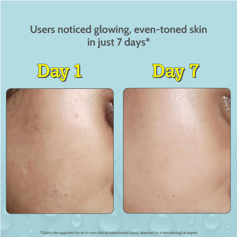 Chemist at Play 10% Vitamin C Face Serum Brightens Skin Treats Dark Spots & Hyperpigmentation