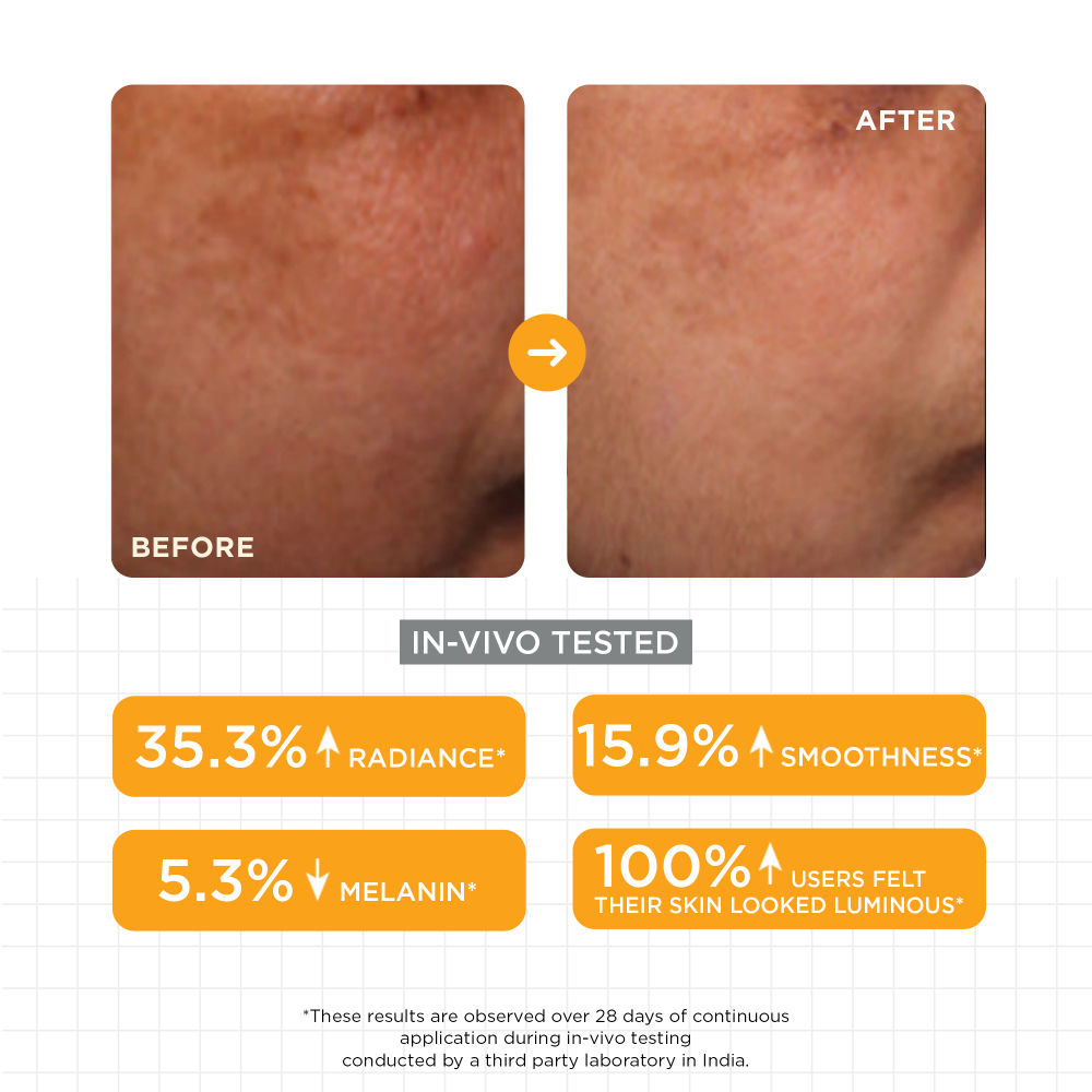SKINQ Brightening Serum with Lactic & Malic Acid