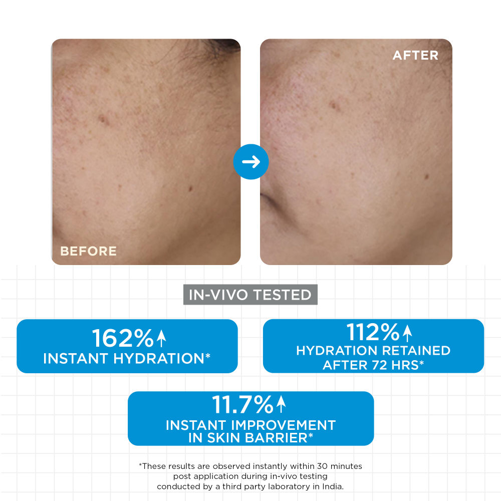 SKINQ Moisture Balm with Ceramides Trio, Sodium Hyaluronate & Vitamin E, For Dry Skin