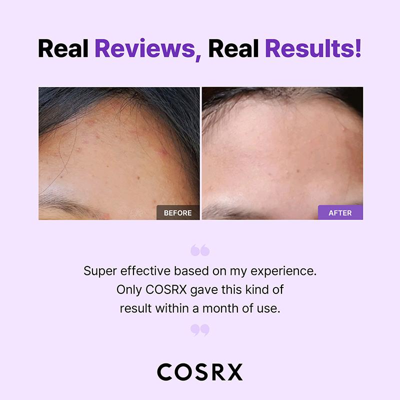 COSRX AHA/BHA Clarifying Treatment Toner