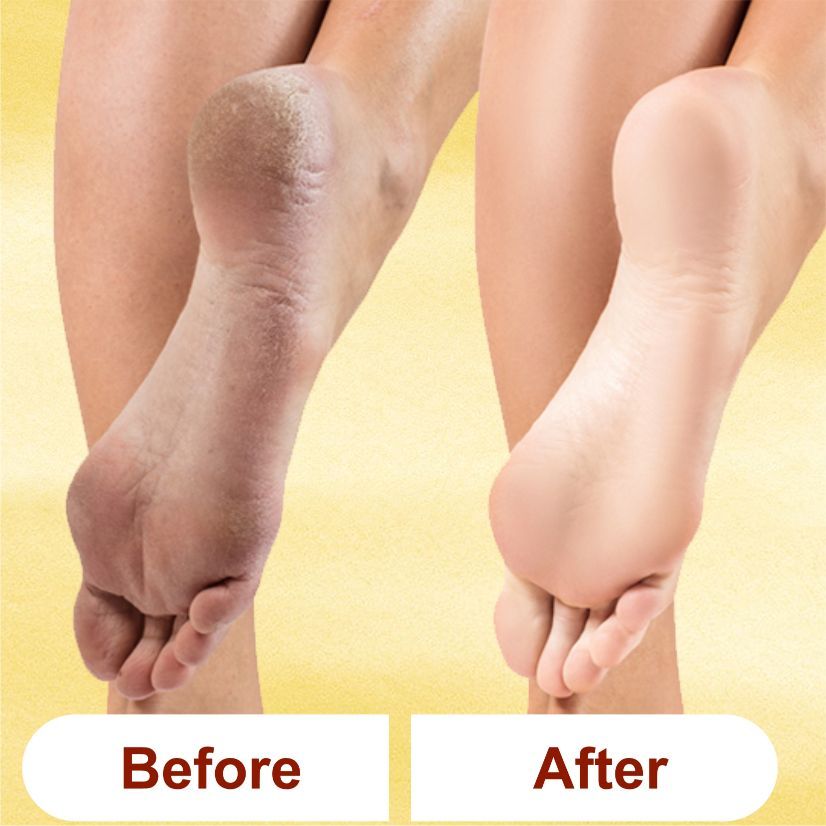 Kazarmaa Heal & Repair Lemon Foot Cream With Shea Butter, Vitamin-e, Coconut Oil & Jojoba Oil