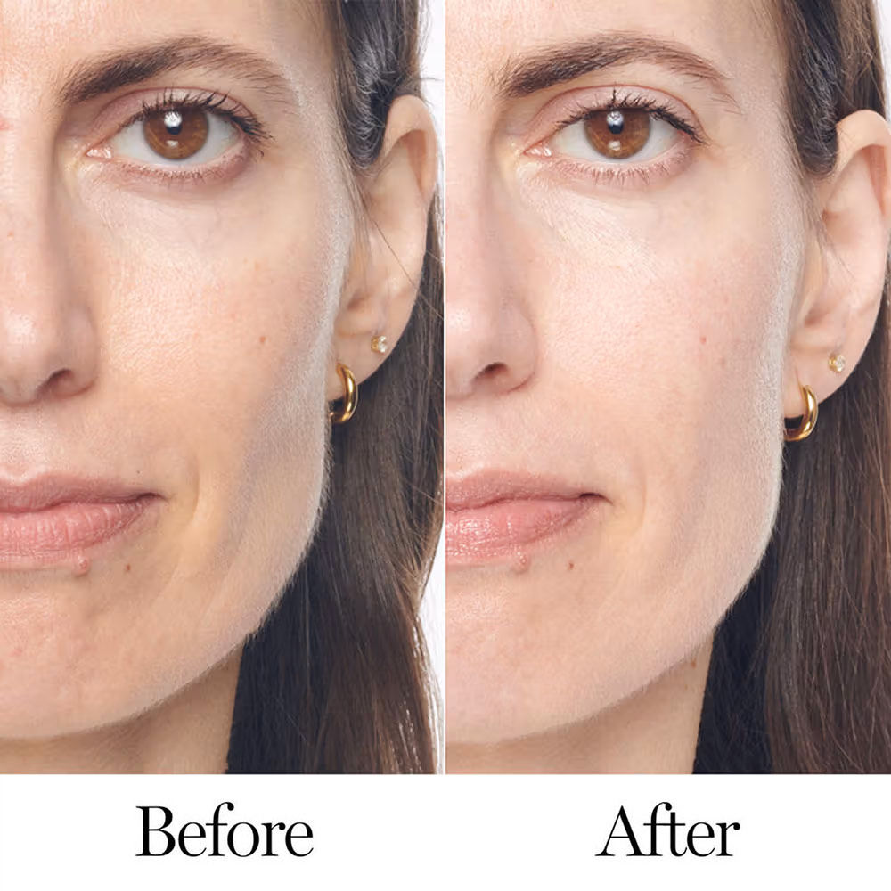 Lancome Renergie H.C.F.Triple Serum for Women Anti Ageing