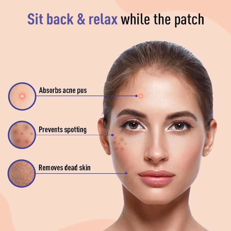 Sirona Anti Acne & Pimple Face Patches, 0.5% Salicylic Acid & 100% Hydrocolloid, Acne Spot Corrector