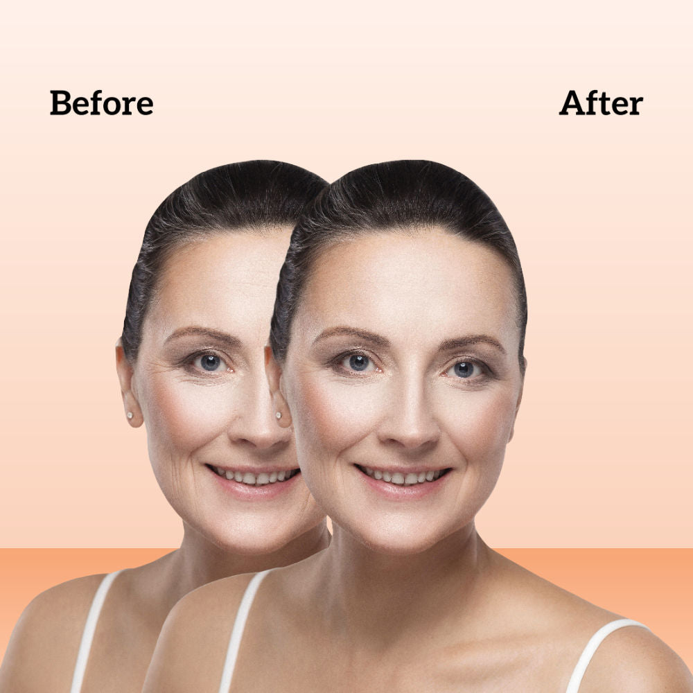 inatur Retinol Night Cream, 1% Retinol & Bakuchiol, Anti-Aging, Hyaluronic Acid & Soya Peptides