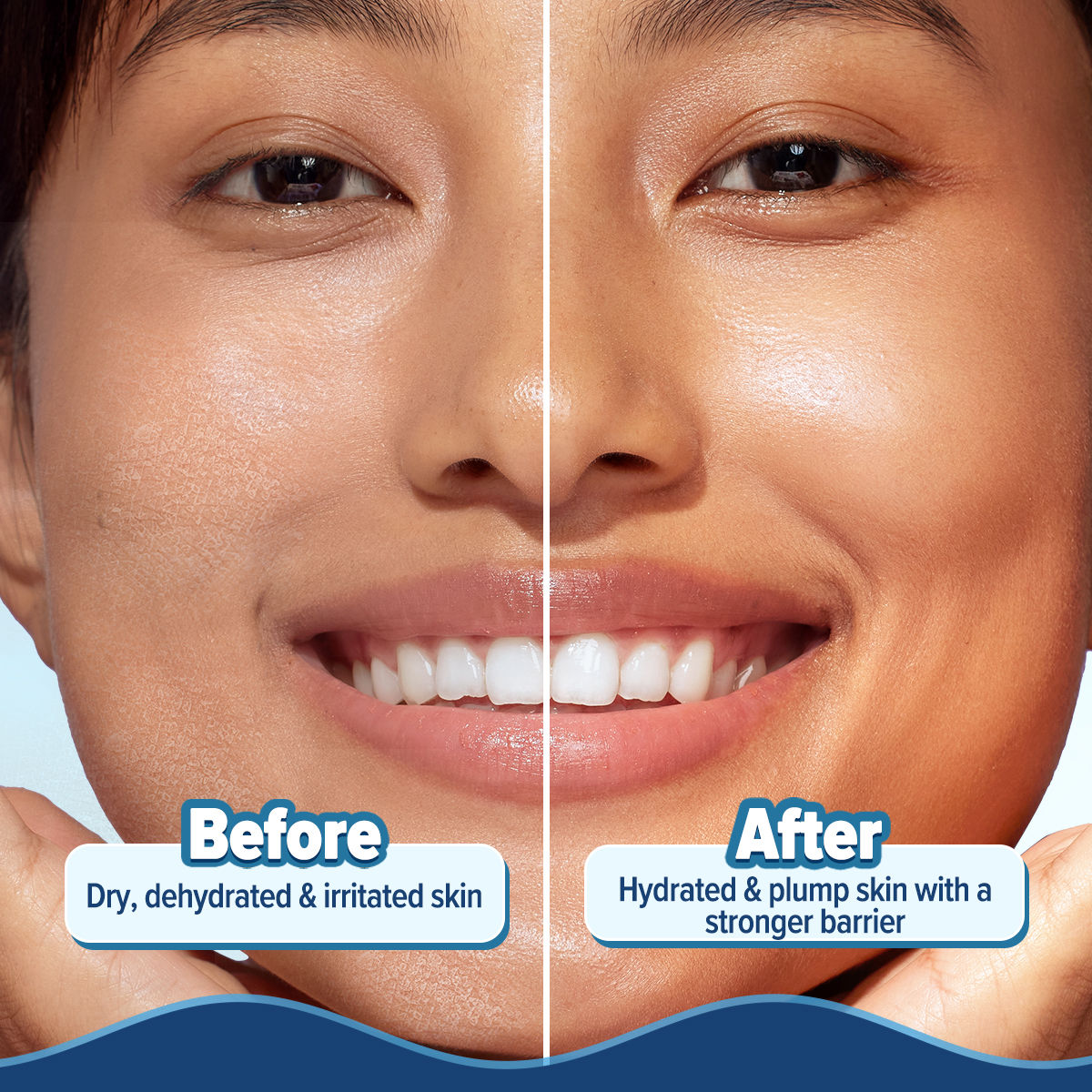 Aqualogica Barrier+ Hydra Gel Moisturizer With 5 Ceramides & Avocado For 24 Hour Intense Hydration