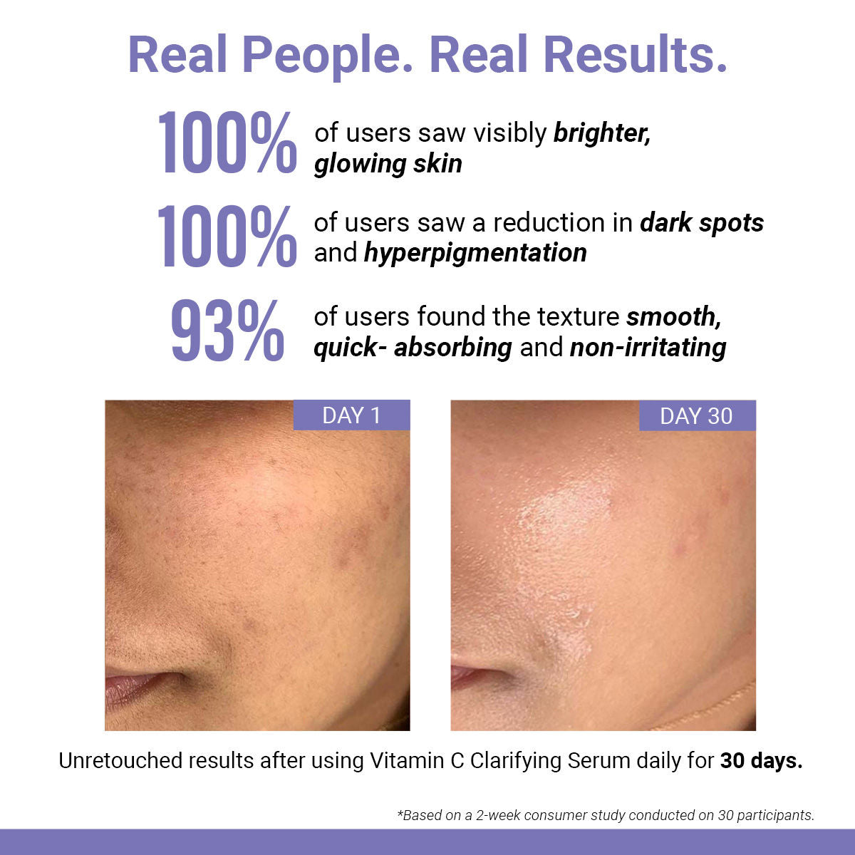Sereko Vitamin C Clarifying Serum With Niacinamide For Glowing Skin, Fades Hyperpigmentation