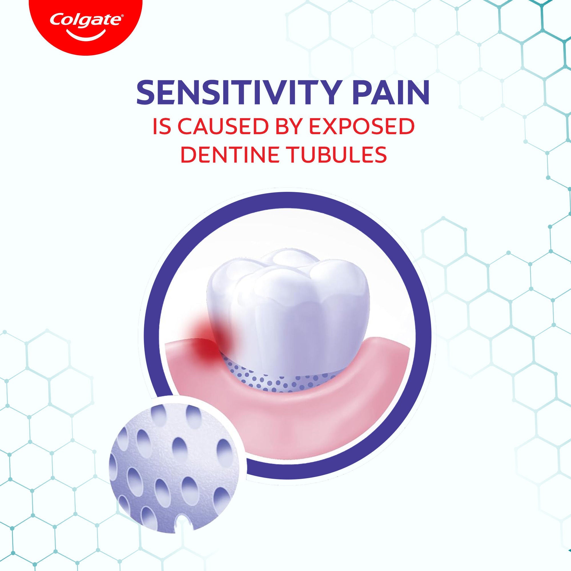 Colgate Sensitive Plus Toothpaste, for Sensitivity Relief, B1G1