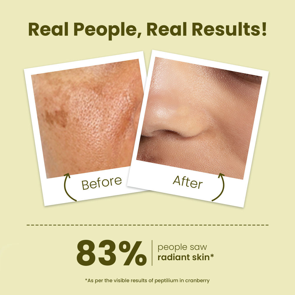 La Pink Young Forever Anti-Aging Night Repair Cream With Bakuchi For Fine Lines & Wrinkles