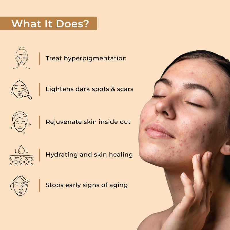Indus Valley Yogurt & Honey Depigmentation Gel, Skin Brightening & Lightening