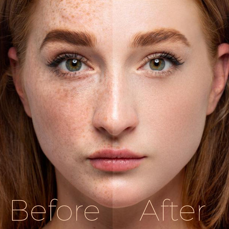 Indus Valley Yogurt & Honey Depigmentation Gel, Skin Brightening & Lightening
