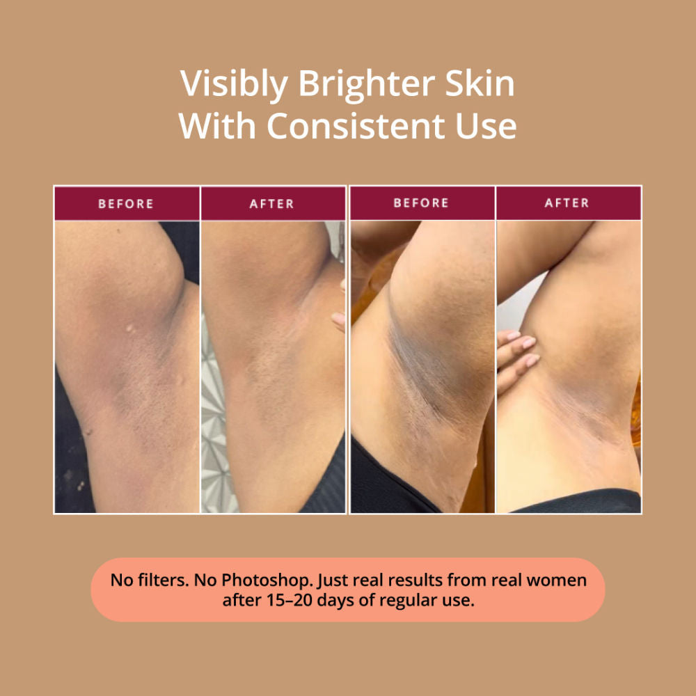 Carmesi Glow Revive Underarm Roll On, Rice Water, AHAs for Pigmentation & Odour Control