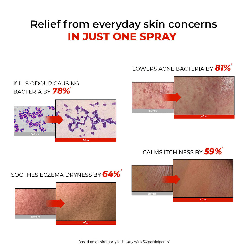 Conscious Chemist HOCL Skin Relief Face & Body Spray