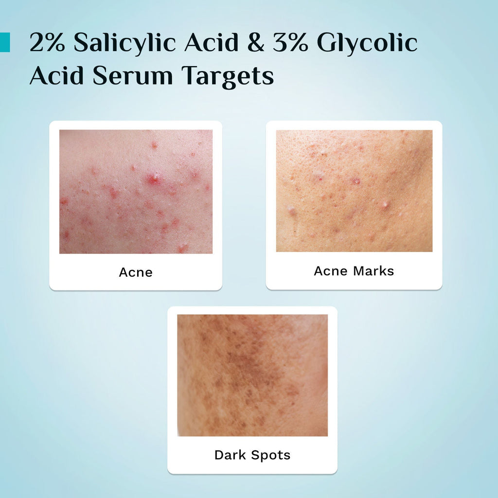 Pilgrim Salicylic & Glycolic Acid Anti Acne Serum