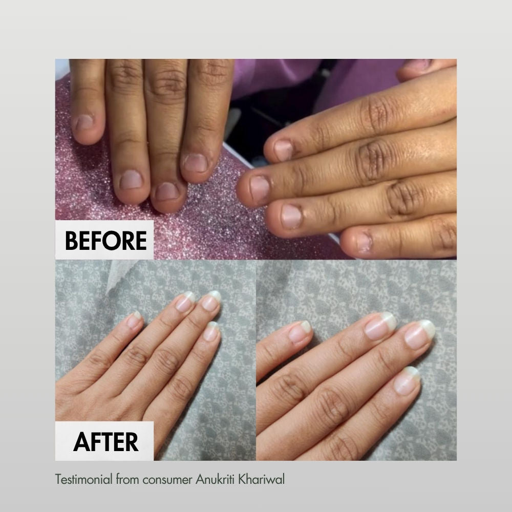 Hibiscus Monkey Nailed It Nail & Cuticle Treatment For Damaged, Brittle & Thin Nails