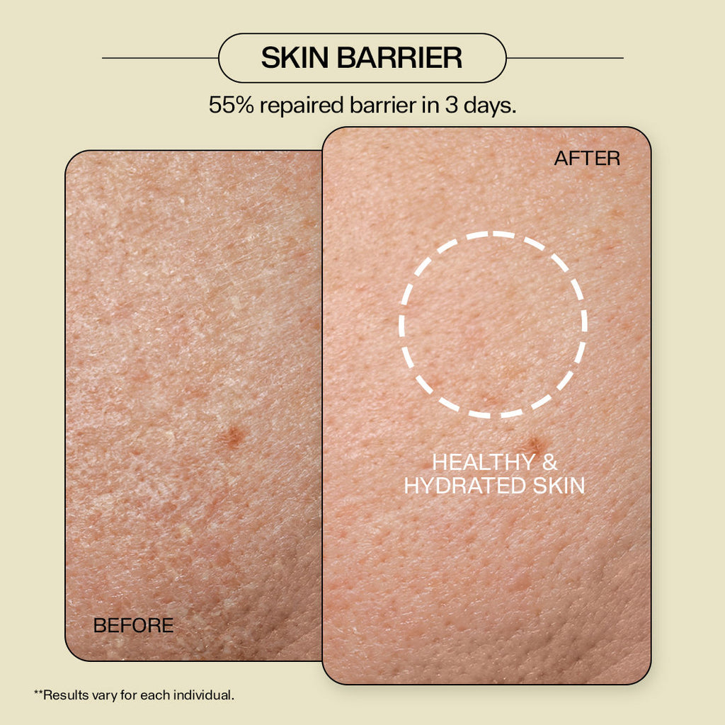 Skindulge 3 in 1 Skin Hydrator (Toner + Serum + Moisturizer) 1.4% Ceramides