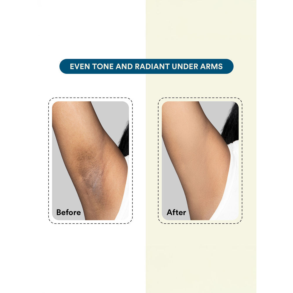 Bloom by Boldcare Bloom Hair Removal Cream No Skin Darkening With Spatula Orange Fragrance