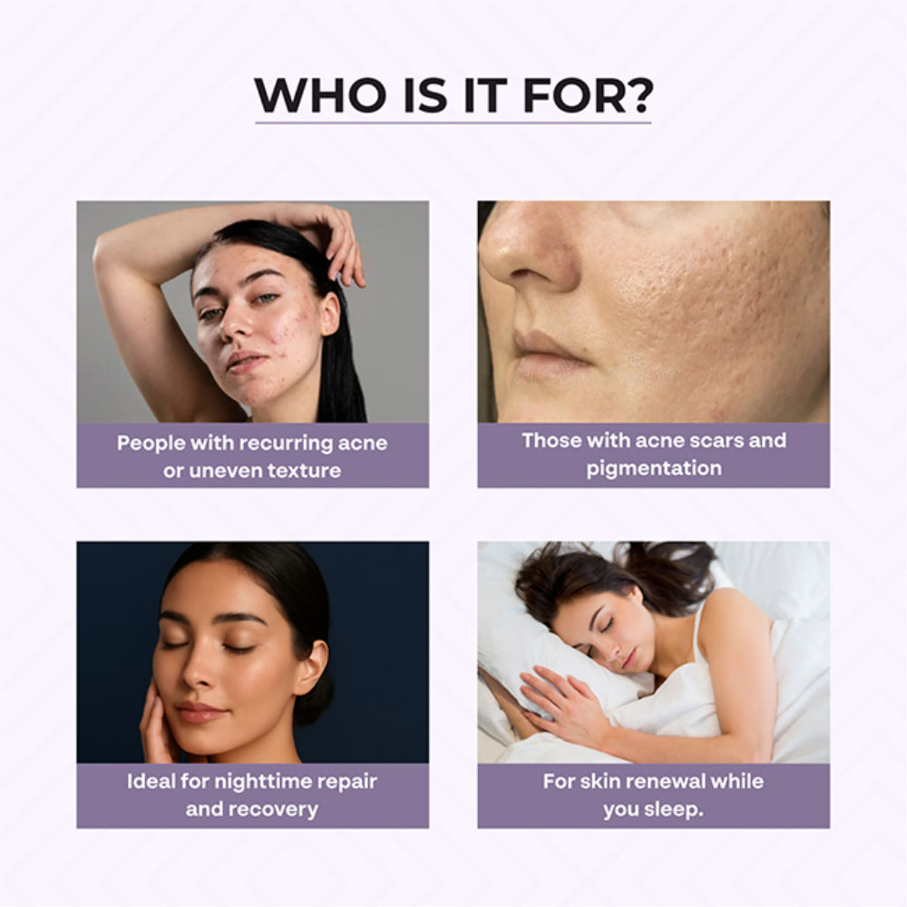 Dr. Sakhiya Acne & Pimple Night Cream