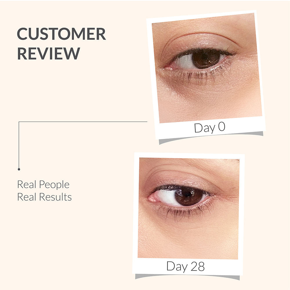AreoVeda Under Eye Serum, Quinoa Seed Extract & CryoCoffee, Visibly Reduces Dark Circles, Puffiness