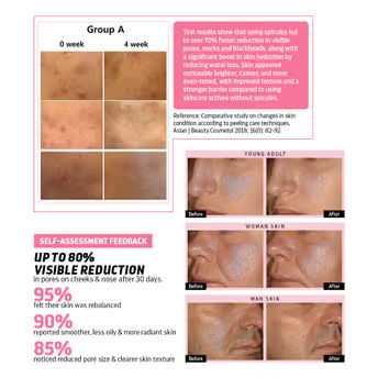 Indulgeo Essentials Cica Reedle Essence With PDRN