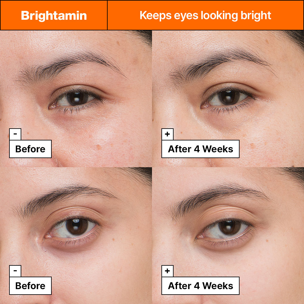 Dr.Jart+ Brightamin Brightening Eye Serum Stick With Vitamin C & E