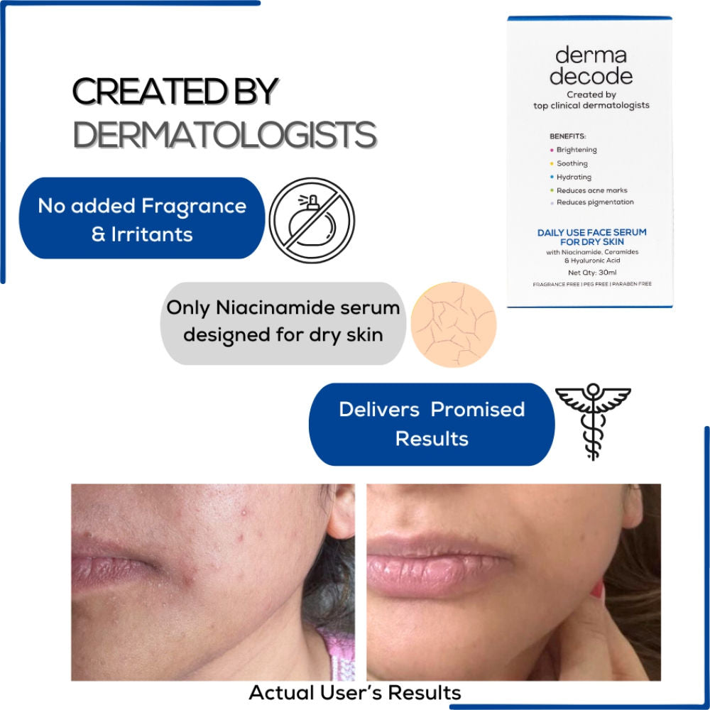 Derma Decode 10% Niacinamide Serum Ceramide And Hyaluronic Acid Repairs Skin Barrier For Dry Skin