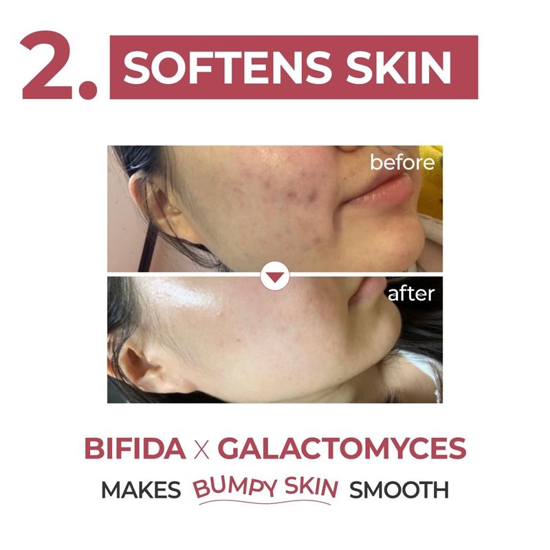 Numbuzin No.3 Skin Softening Serum, Pore Tightening Serum, Bifida & Galactomyces, Boosts Elasticity