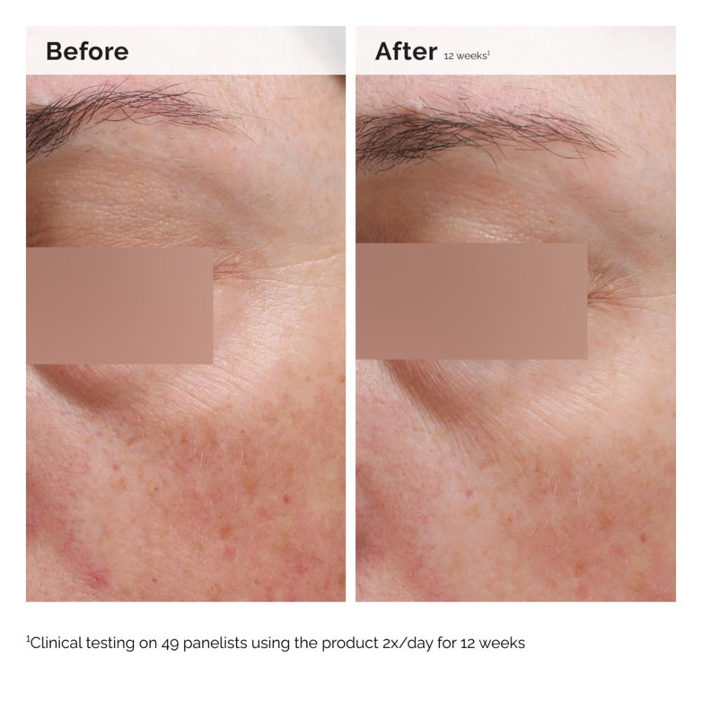 The Ordinary Niacinamide 5% Face & Body Emulsion